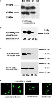 Epitopes for Multivalent Vaccines Against Listeria, Mycobacterium and Streptococcus spp: A Novel Role for Glyceraldehyde-3-Phosphate Dehydrogenase
